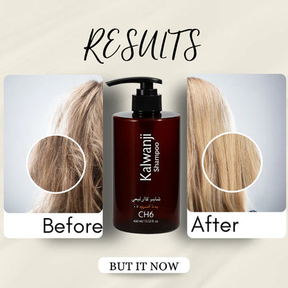 Organic Kalwanji Black Seed Shampoo 250ml (Buy 1 Get 1 Free)