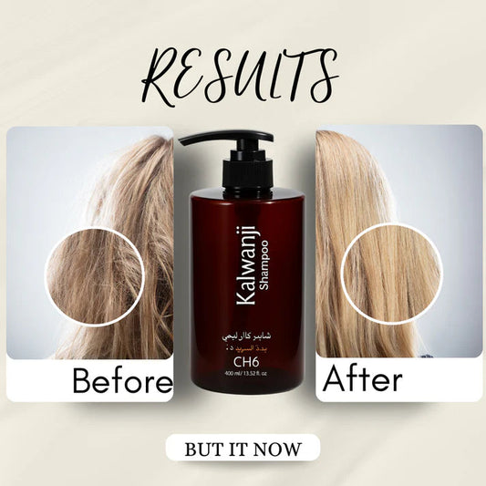 Organic Kalwanji Black Seed Shampoo 250ml (Buy 1 Get 1 Free)